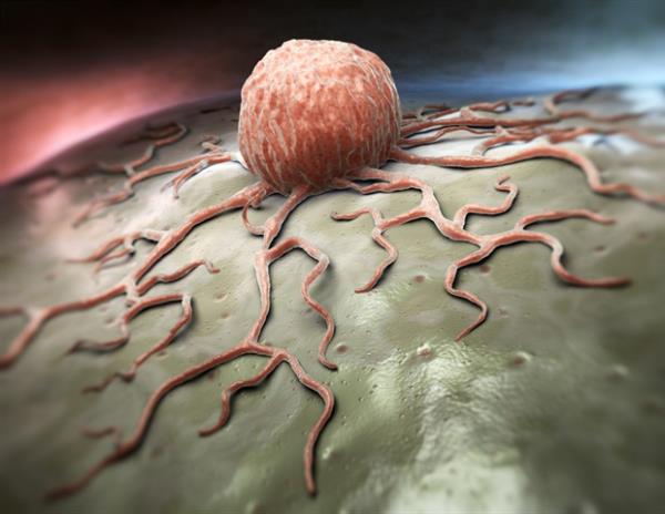 研究表明，癌细胞在酸性环境中进行脂质合成和积累