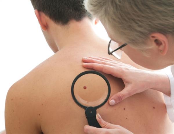 老化皮肤硬度的增加可能导致皮肤癌转移率升高