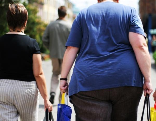 肥胖和高脂肪饮食会加速脑血管老化