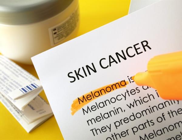 致命的皮肤癌现在威胁着20多岁的女性
