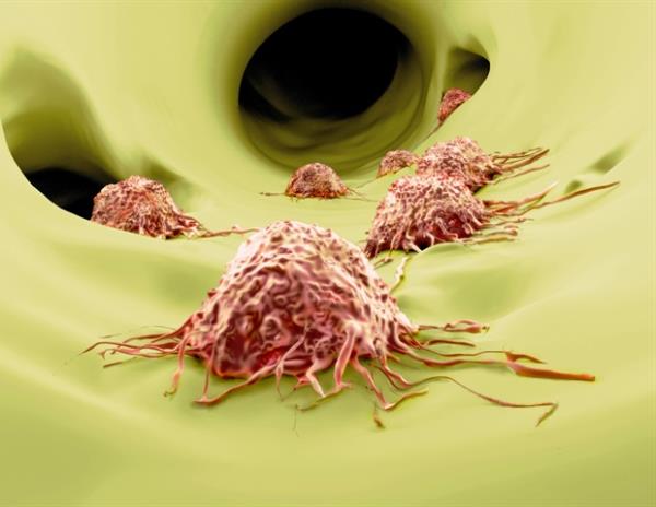 人类乳腺肿瘤的“微环境”为其转移做好了准备